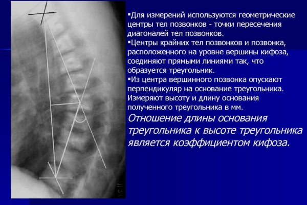 Кракен даркнет тг